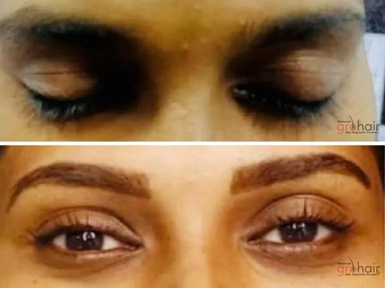 Before and After 2