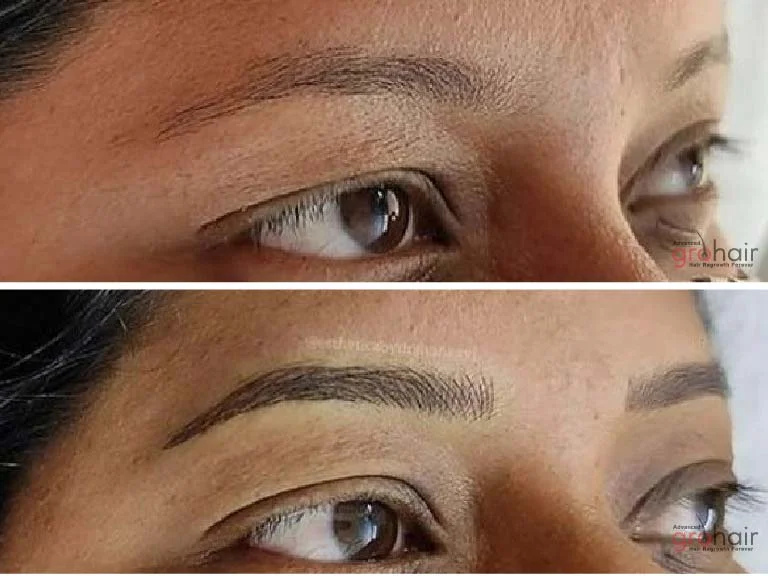 Before and After 3