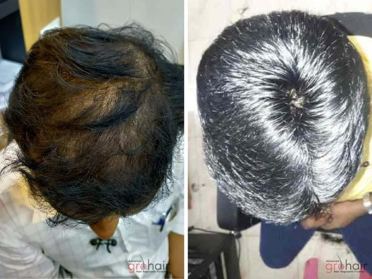 Before and After 4