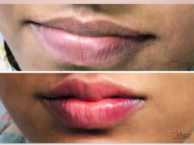Before and After 1