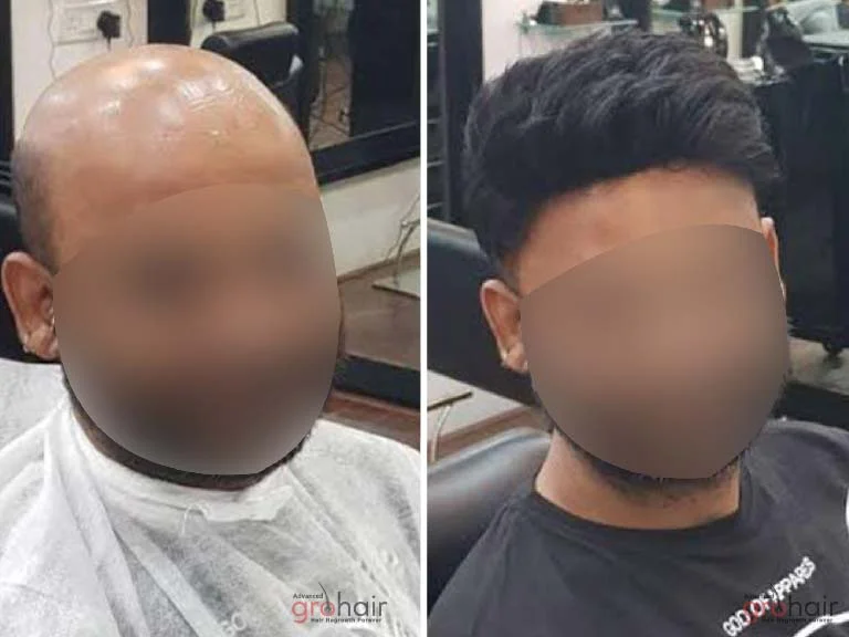 Before and After 3