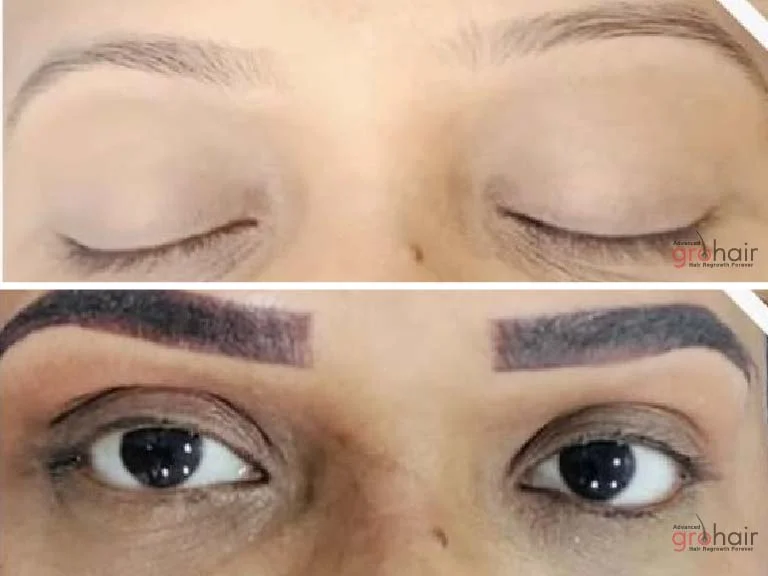 Before and After 1