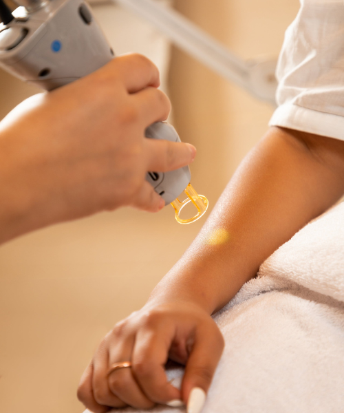 Laser Hair Removal