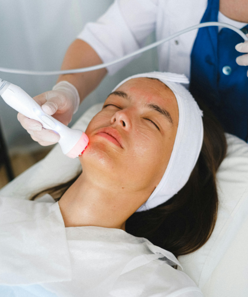RF Skin Tightening